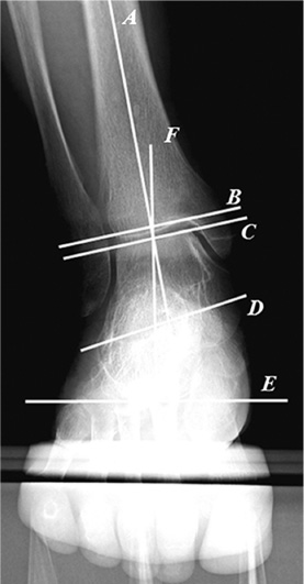 足の外科リサーチ | 京都府立医科大学 整形外科